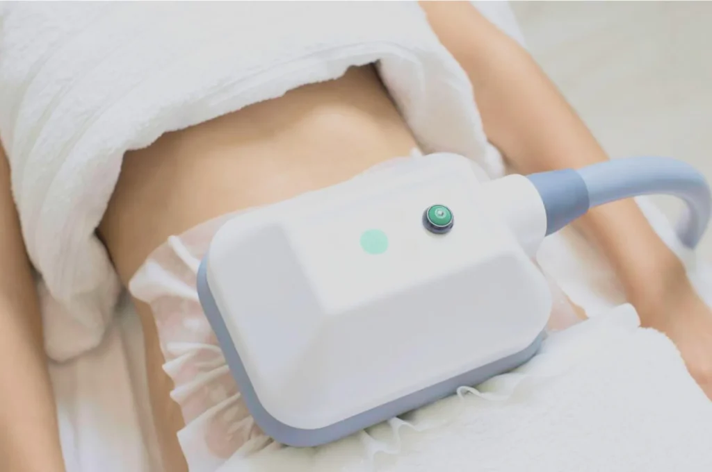 How Fat Freezing and HIFU Work Together? 3 advantages to combining Fat Freezing and HIFU Wivenhoe