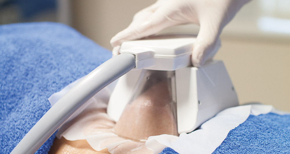 How Fat Freezing and HIFU Work Together? 2 Multiple Areas in One Session HIFU and Fat Freezing Wivenhoe