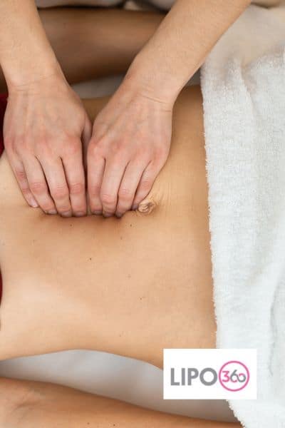 diastasis recti treatment Wivenhoe