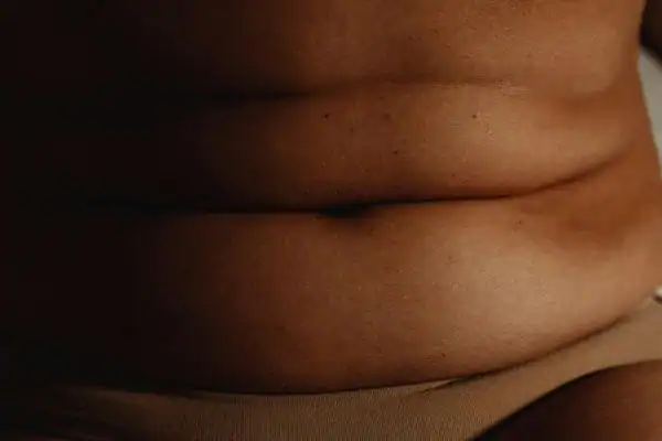 The Hidden Connection: How Stress Shapes Your Fitness and Body Composition 3 image of what stress can do on the stomach area and how Lipo 360 Wivenhoe can help to change your body shape.