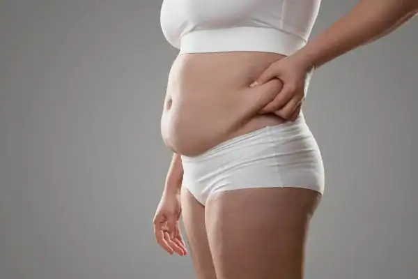 Image of stress belly Wivenhoe How Lipo 360 can help manage your symptoms